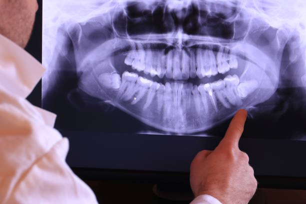 Best Emergency Root Canal Therapy in Comanche, TX